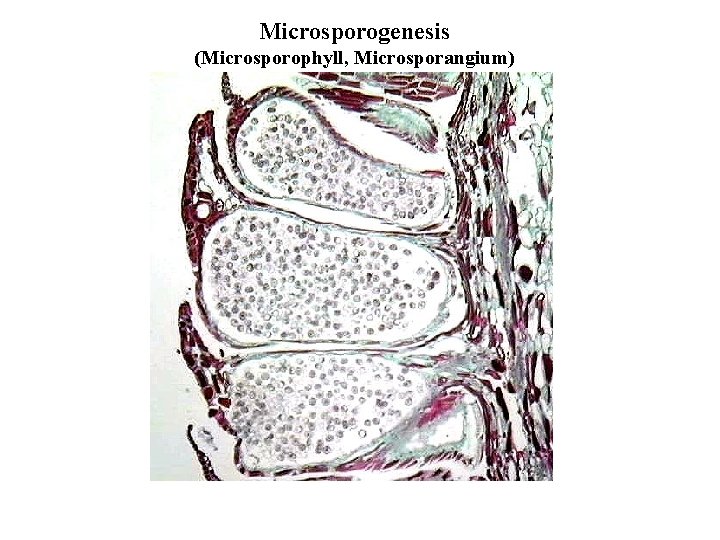 Microsporogenesis (Microsporophyll, Microsporangium) 