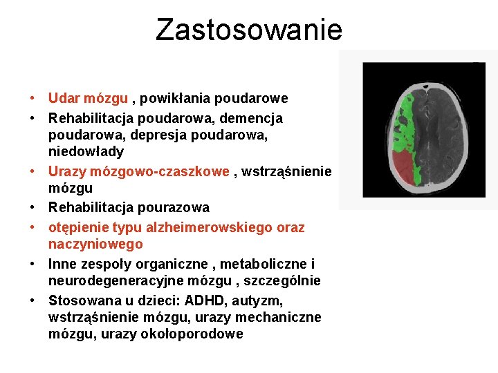 Zastosowanie • Udar mózgu , powikłania poudarowe • Rehabilitacja poudarowa, demencja poudarowa, depresja poudarowa,