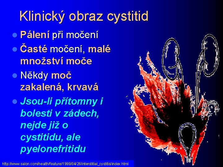 Klinický obraz cystitid l Pálení při močení l Časté močení, malé množství moče l