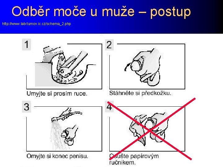 Odběr moče u muže – postup http: //www. lab-turnov. ic. cz/schema_2. php 