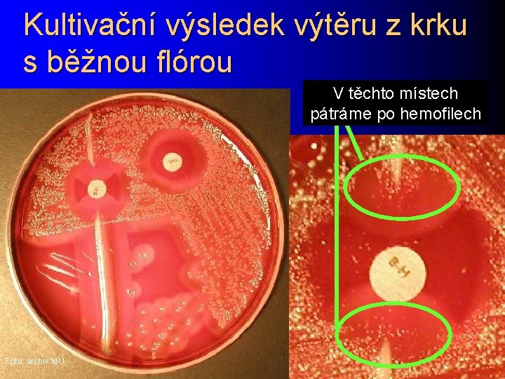 Kultivační výsledek výtěru z krku s běžnou flórou V těchto místech pátráme po hemofilech