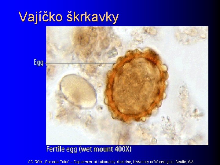 Vajíčko škrkavky CD-ROM „Parasite-Tutor“ – Department of Laboratory Medicine, University of Washington, Seatle, WA