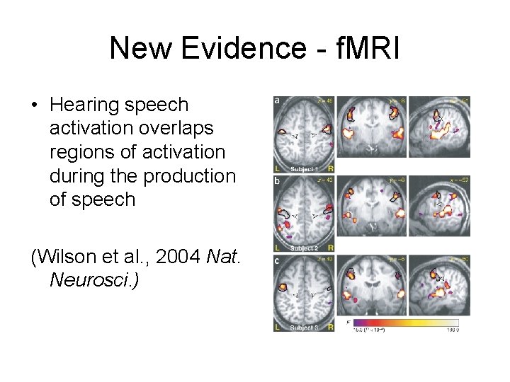 New Evidence - f. MRI • Hearing speech activation overlaps regions of activation during