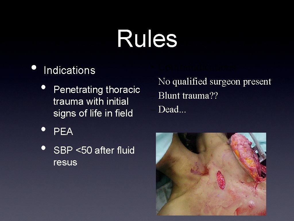 Rules • Indications • • • Penetrating thoracic trauma with initial signs of life