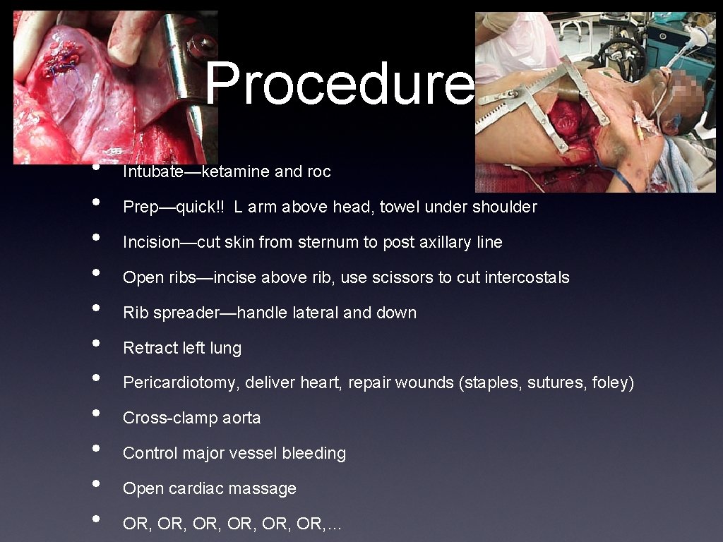 Procedure • • • Intubate—ketamine and roc Prep—quick!! L arm above head, towel under