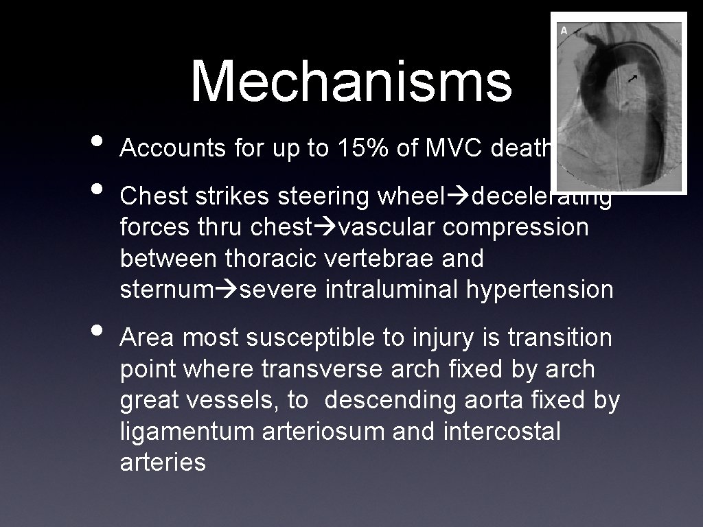 Mechanisms • • • Accounts for up to 15% of MVC deaths Chest strikes