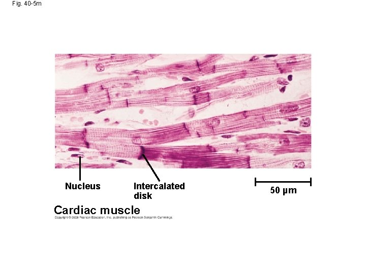 Fig. 40 -5 m Nucleus Intercalated disk Cardiac muscle 50 µm 