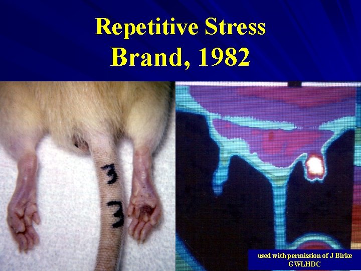 Repetitive Stress Brand, 1982 used with permission of J Birke GWLHDC 