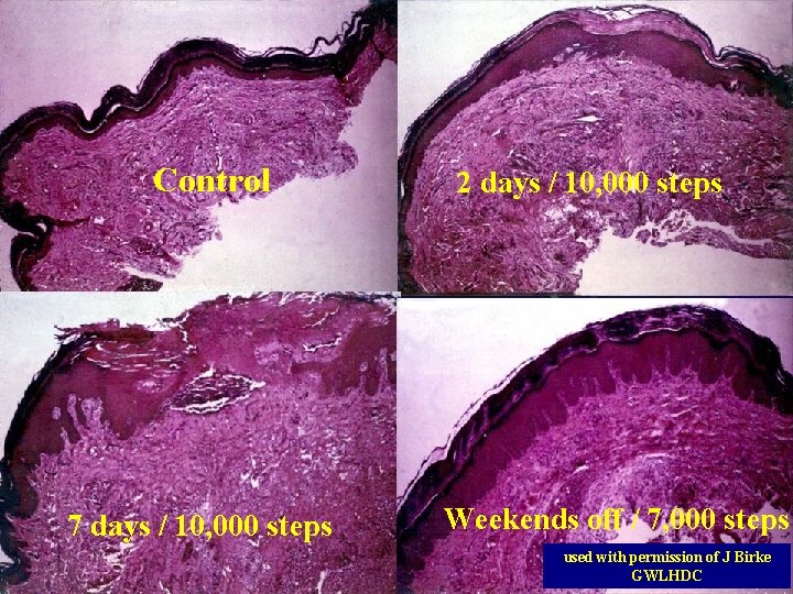 Control 7 days / 10, 000 steps 2 days / 10, 000 steps Weekends