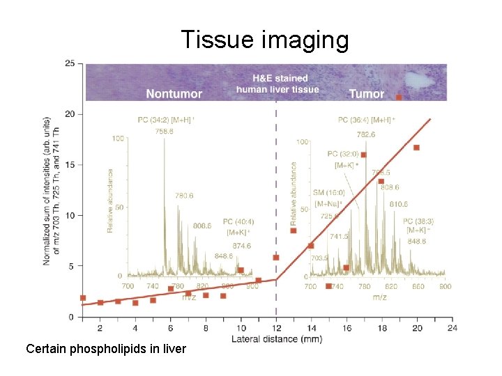 Tissue imaging Certain phospholipids in liver 