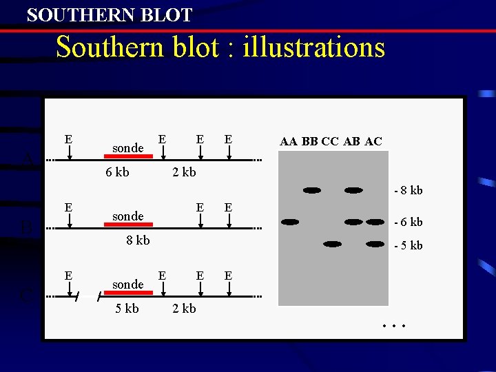 SOUTHERN BLOT Southern blot : illustrations E A sonde E 6 kb E E SOUTHERN BLOT Southern blot : illustrations E A sonde E 6 kb E E