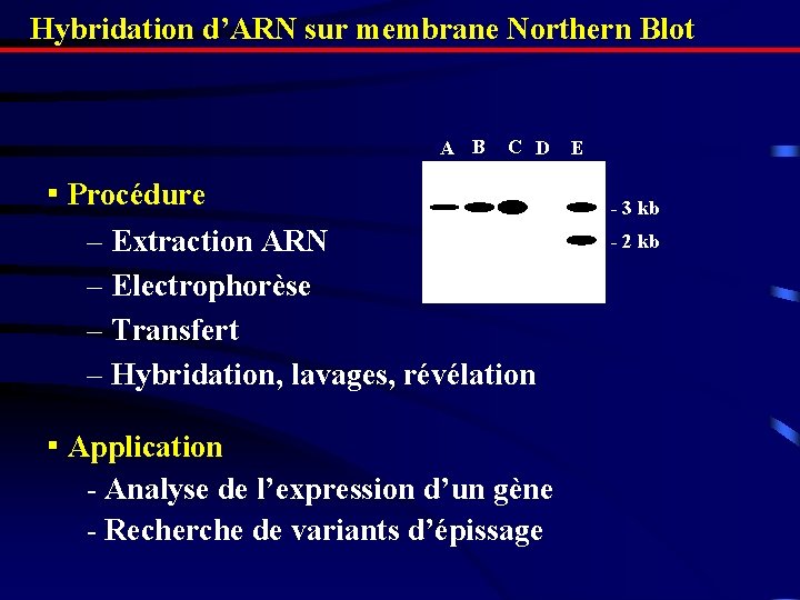 Hybridation d’ARN sur membrane Northern Blot AA B CC D ▪ Procédure – Extraction Hybridation d’ARN sur membrane Northern Blot AA B CC D ▪ Procédure – Extraction