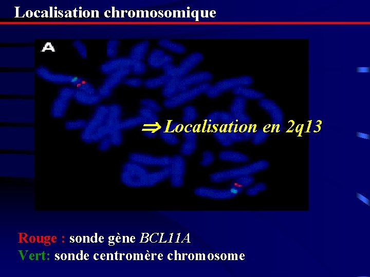 Localisation chromosomique Localisation en 2 q 13 Rouge : sonde gène BCL 11 A Localisation chromosomique Localisation en 2 q 13 Rouge : sonde gène BCL 11 A