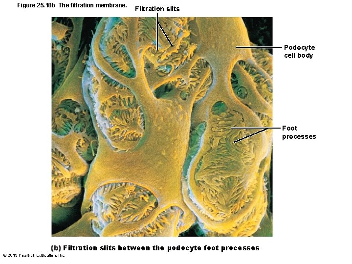 Figure 25. 10 b The filtration membrane. Filtration slits Podocyte cell body Foot processes