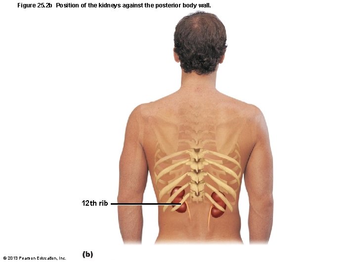 Figure 25. 2 b Position of the kidneys against the posterior body wall. 12