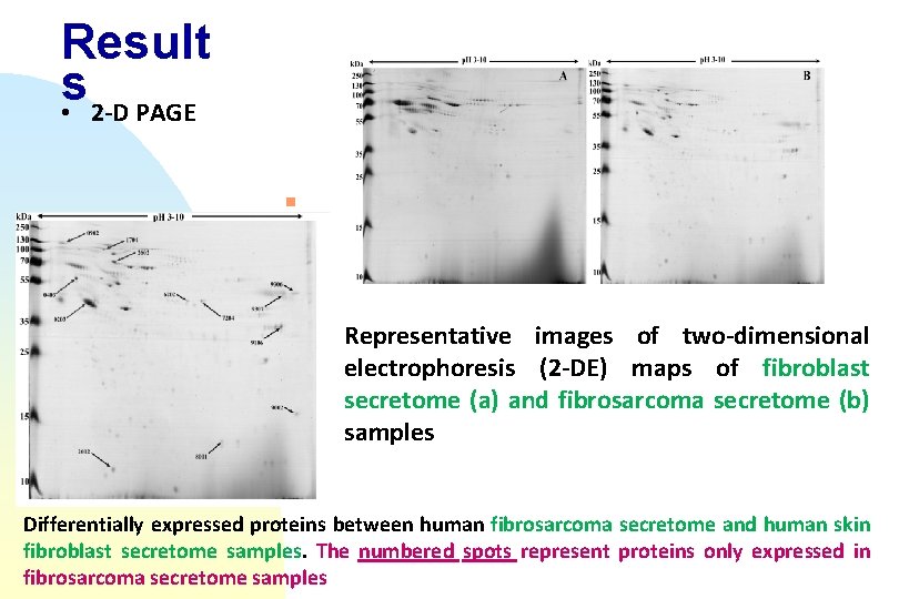 Result s • 2 -D PAGE n 2 -D PAGE Representative images of two-dimensional