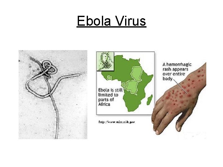 Ebola Virus 