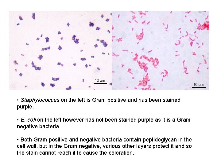  • Staphylococcus on the left is Gram positive and has been stained purple.