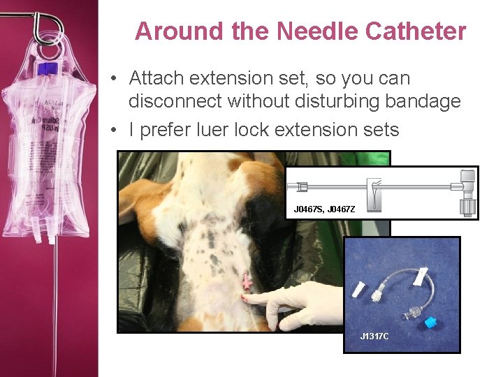 Around the Needle Catheter • Attach extension set, so you can disconnect without disturbing