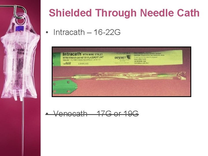 Shielded Through Needle Cath • Intracath – 16 -22 G • Venocath – 17