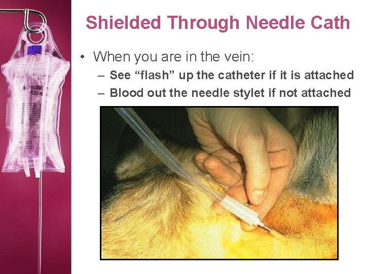 Shielded Through Needle Cath • When you are in the vein: – See “flash”