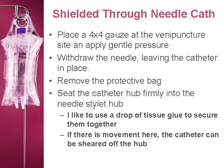 Shielded Through Needle Cath • Place a 4 x 4 gauze at the venipuncture