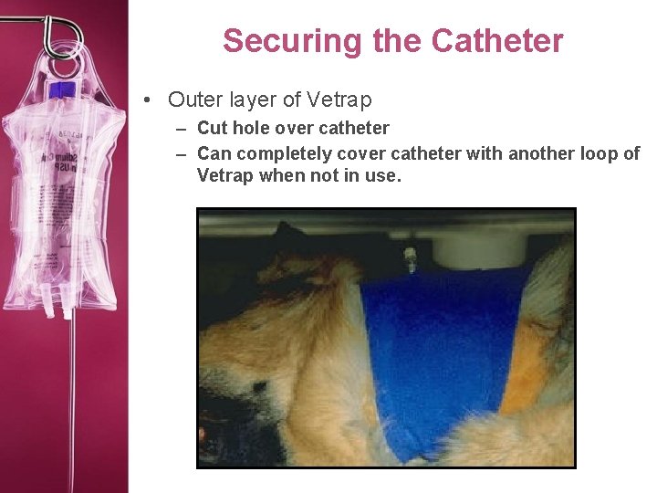 Securing the Catheter • Outer layer of Vetrap – Cut hole over catheter –