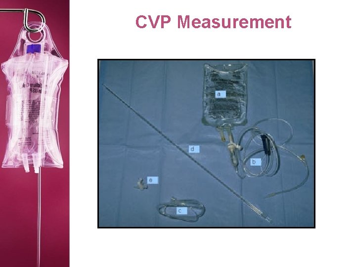 CVP Measurement 
