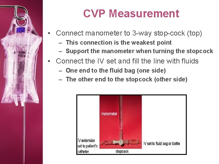 CVP Measurement • Connect manometer to 3 -way stop-cock (top) – This connection is