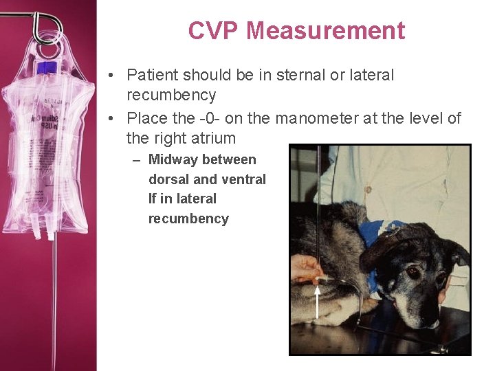 CVP Measurement • Patient should be in sternal or lateral recumbency • Place the