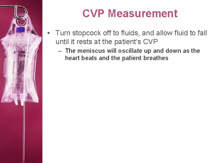 CVP Measurement • Turn stopcock off to fluids, and allow fluid to fall until