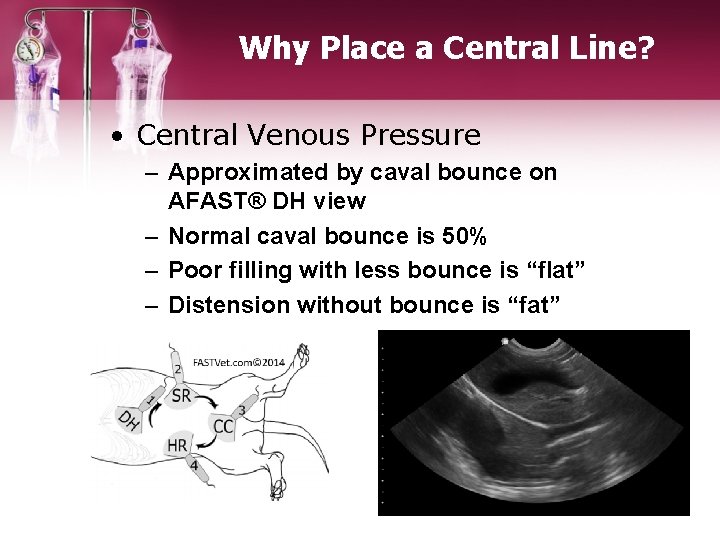 Why Place a Central Line? • Central Venous Pressure – Approximated by caval bounce