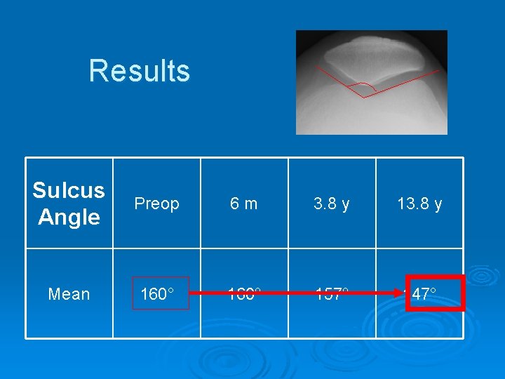 Results Sulcus Angle Preop 6 m 3. 8 y 13. 8 y Mean 160°