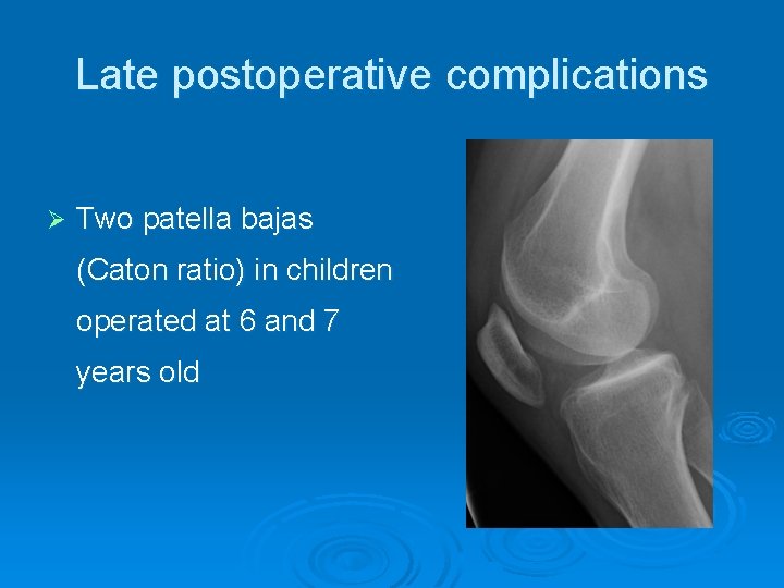 Late postoperative complications Ø Two patella bajas (Caton ratio) in children operated at 6