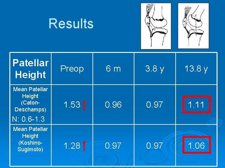 Results Patellar Height Mean Patellar Height (Caton. Deschamps) Preop 6 m 3. 8 y