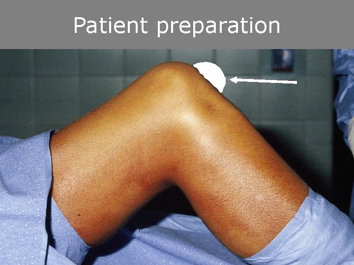 Patient preparation 