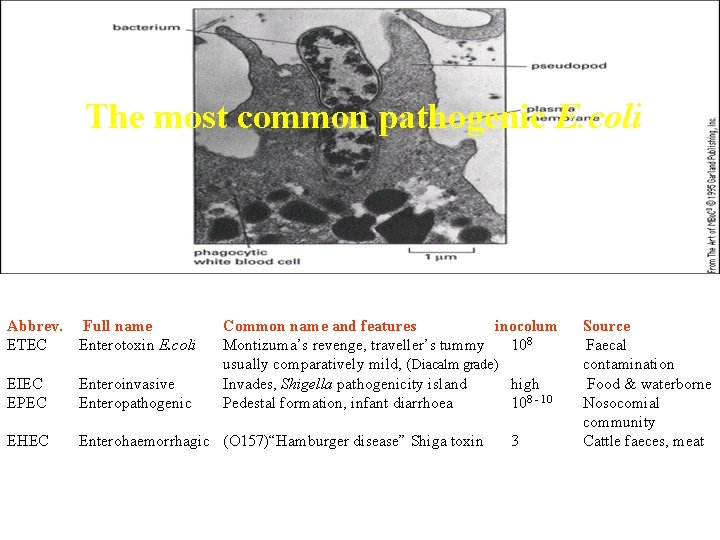 The most common pathogenic E. coli Abbrev. ETEC EIEC EPEC EHEC Full name Enterotoxin