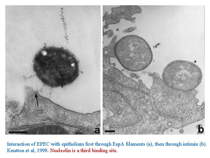 Interaction of EPEC with epithelium first through Esp. A filaments (a), then through intimin