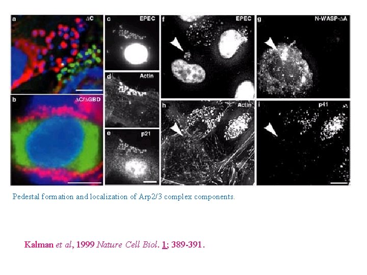 Pedestal formation and localization of Arp 2/3 complex components. Kalman et al, 1999 Nature