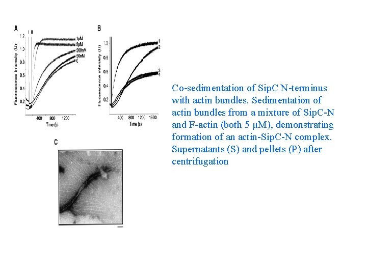 Co-sedimentation of Sip. C N-terminus with actin bundles. Sedimentation of actin bundles from a