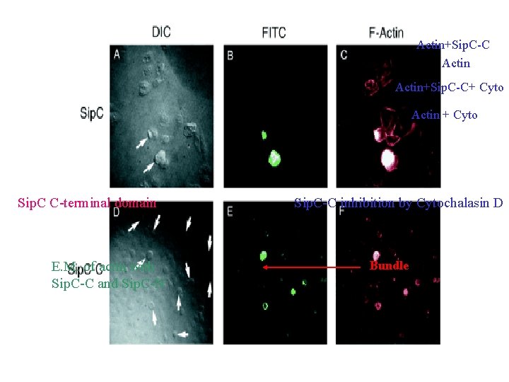 Actin+Sip. C-C+ Cyto Actin + Cyto Sip. C C-terminal domain E. M. of actin