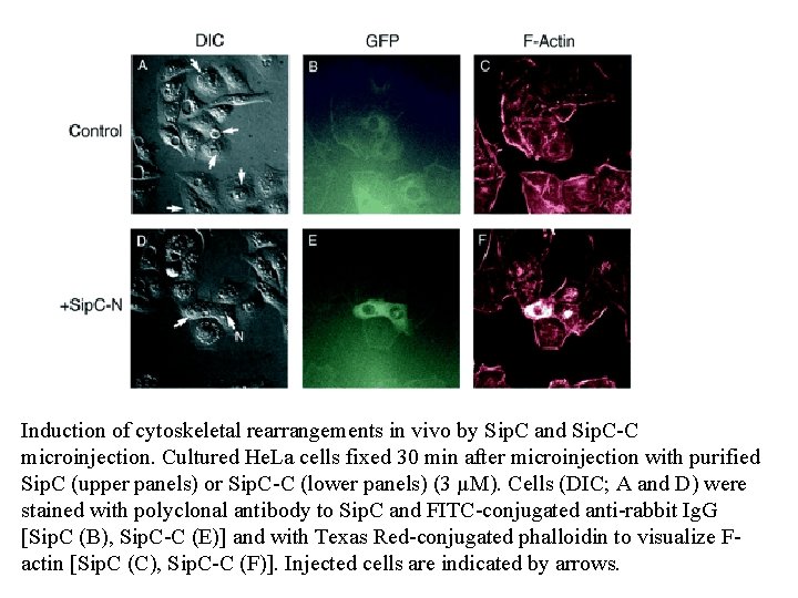 Induction of cytoskeletal rearrangements in vivo by Sip. C and Sip. C-C microinjection. Cultured