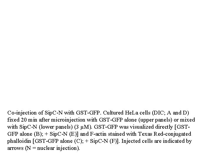 Co-injection of Sip. C-N with GST-GFP. Cultured He. La cells (DIC; A and D)