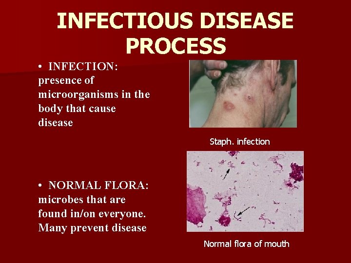 INFECTIOUS DISEASE PROCESS • INFECTION: presence of microorganisms in the body that cause disease