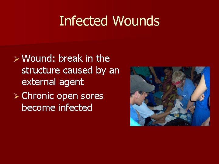 Infected Wounds Ø Wound: break in the structure caused by an external agent Ø