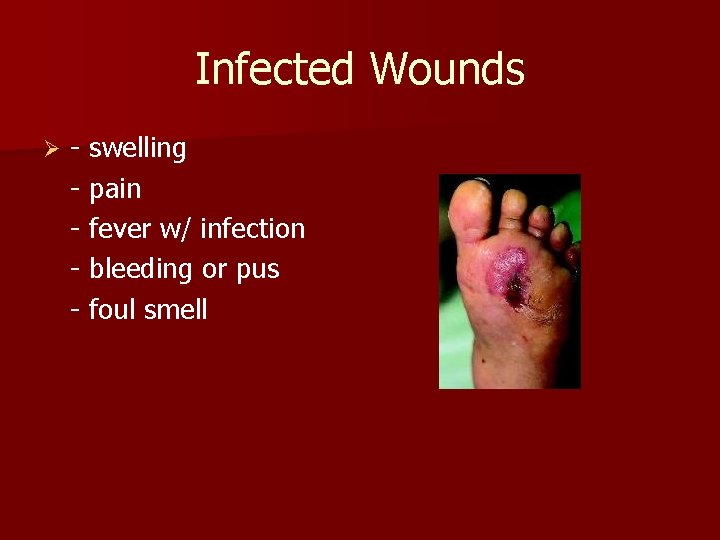 Infected Wounds Ø - swelling - pain - fever w/ infection - bleeding or