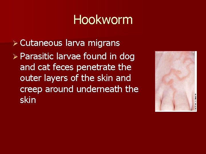 Hookworm Ø Cutaneous larva migrans Ø Parasitic larvae found in dog and cat feces