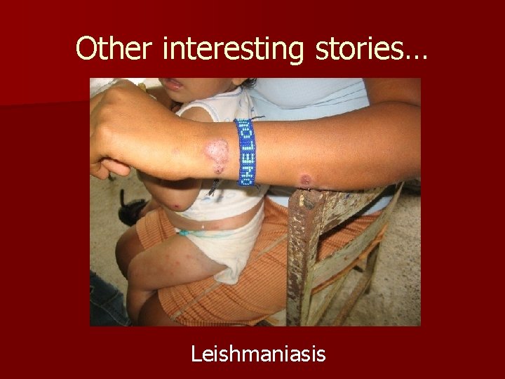 Other interesting stories… Leishmaniasis 