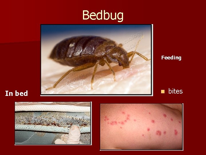 Bedbug Feeding In bed n bites 