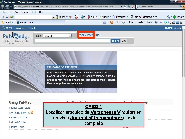 CASO 1 Localizar artículos de Verscheure V (autor) en la revista Journal of immunology